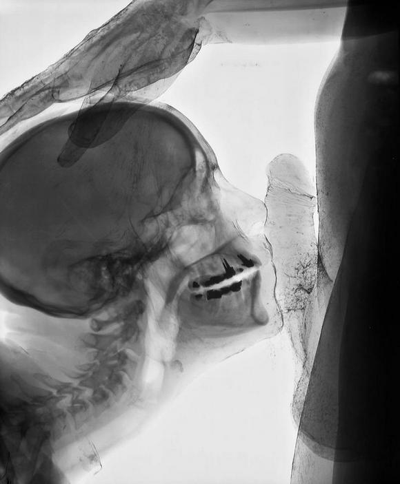 ��������� ���� ���� ������ ��� ��������� (�������-��������)