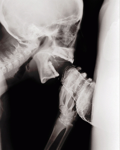 ��������� ���� ���� ������ ��� ��������� (�������-��������)